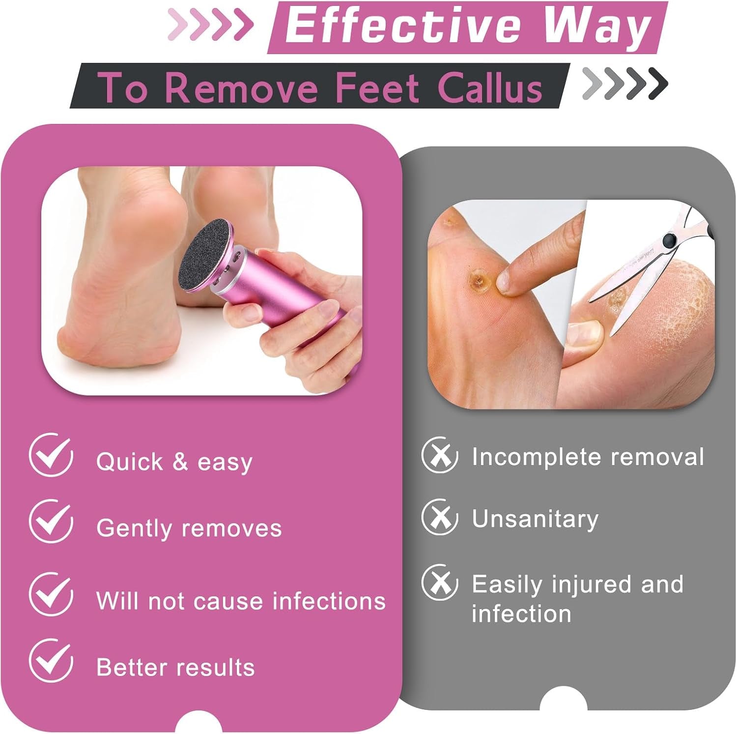 Electric Callus Remover, Foot Nail File Grinder Tool with Speed Controller and 60PCS Replacement Sandpaper Disk, Pedicure Tool Feet Scrubber for Dead Dry Crack Skin Calluses